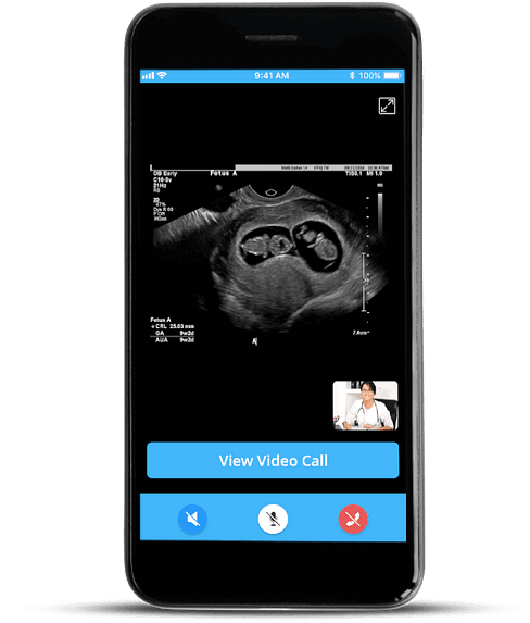 ultrasound-video-streaming-black-mob-mockup
